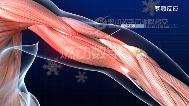 医学病理《发热过程》